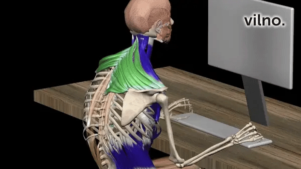 How NOBEL supports a more open sitting position